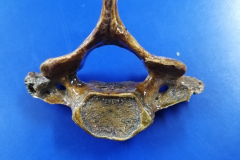 cervical