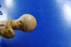 femur1