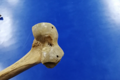 femur2