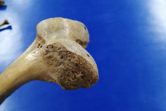 femur3
