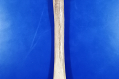 femur4
