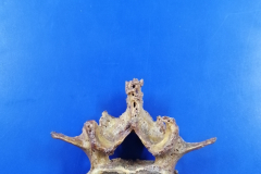 lumbar1
