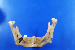 mandíbula1