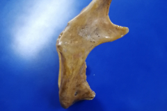 mandíbula2