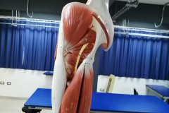 minferior4