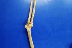 msuperiorarticulado