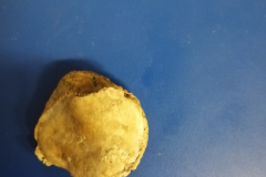 rotula1