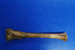 tibia2