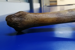 tibia5